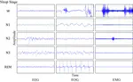 Researches on Sleep Staging based on Multivariate Multimodal Signals
